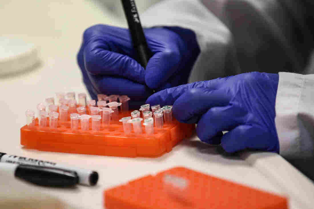 How Can You Tell If A COVID-19 Vaccine Is Working? 1