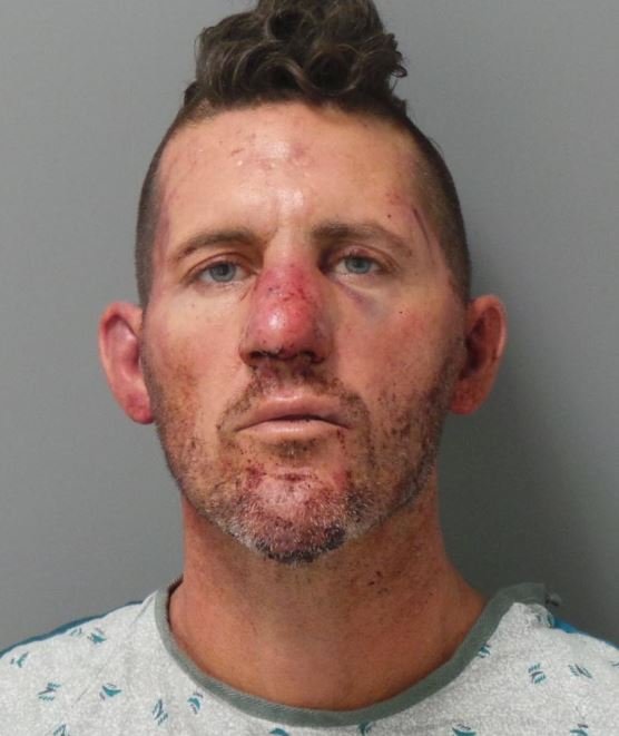 Man arrested for murdering one officer, shooting second one
is upset about his broken nose 1