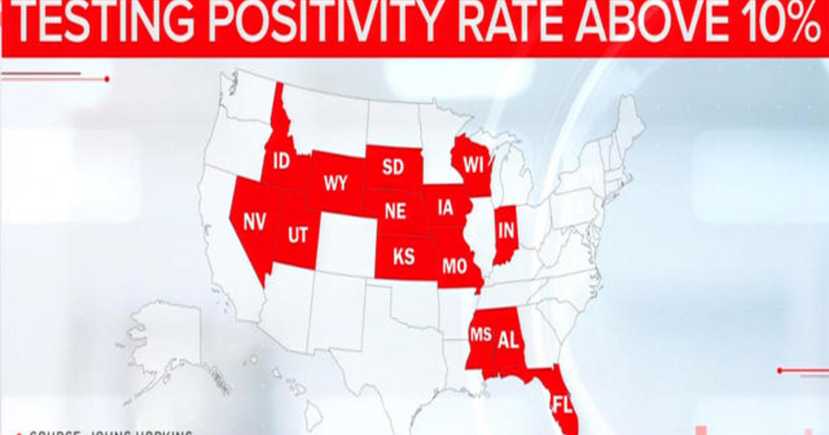 Some states eye reopening, even as COVID test positivity
rates in more than a dozen hang above 10% 1