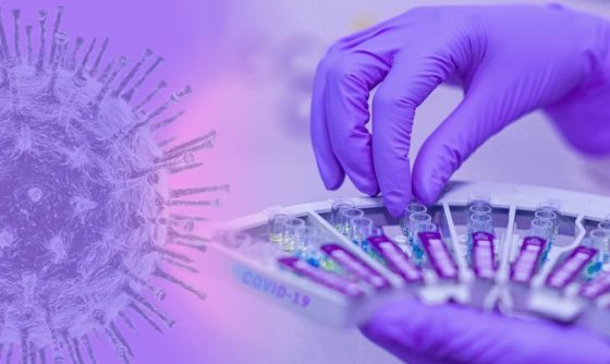 COVID-19 CASES SURGE AS “SECOND WAVE GATHERS PACE”, PREPARE
FOR ANOTHER LOCKDOWN 1