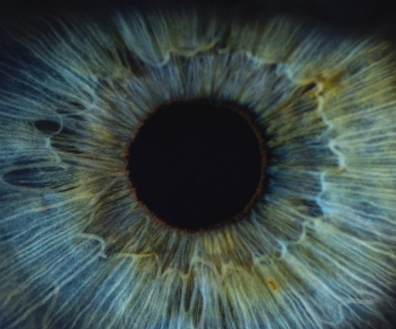 Autopsies Show Coronavirus in the Eyeballs of
Victims 1
