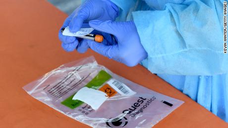Don't get a false sense of security with Covid-19 testing.
Here's why you can test negative but still be infected and
contagious 1