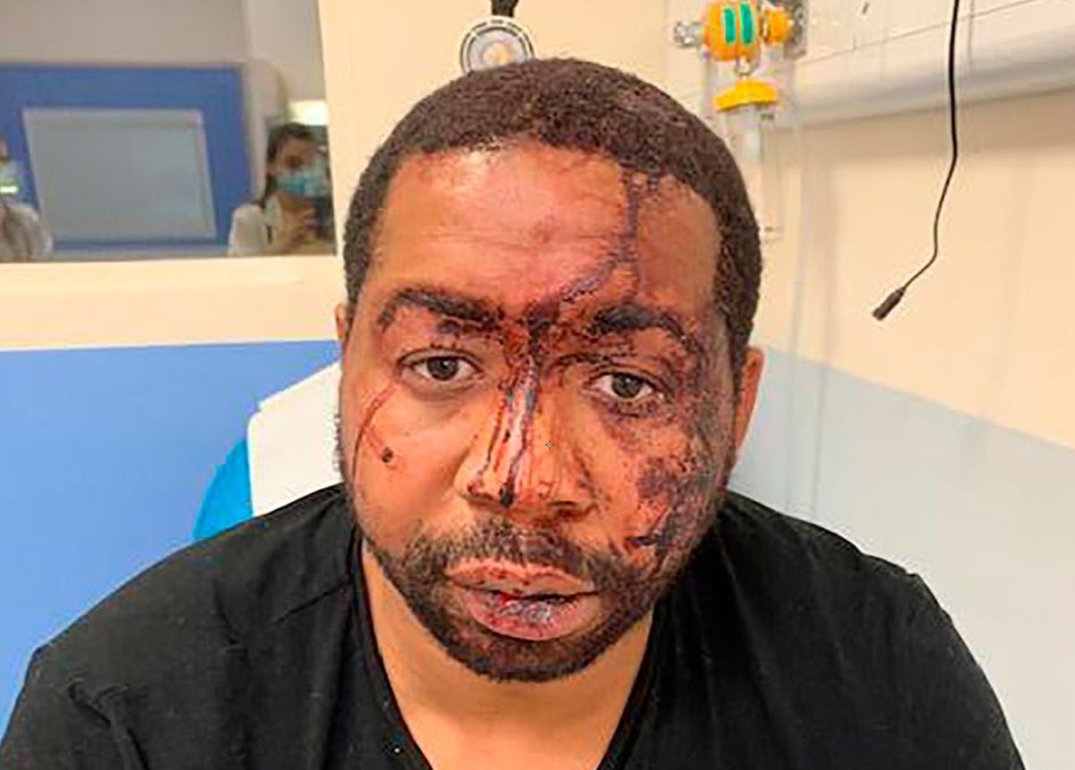 Paris police officers suspended over video showing brutal
arrest of Black music producer 1