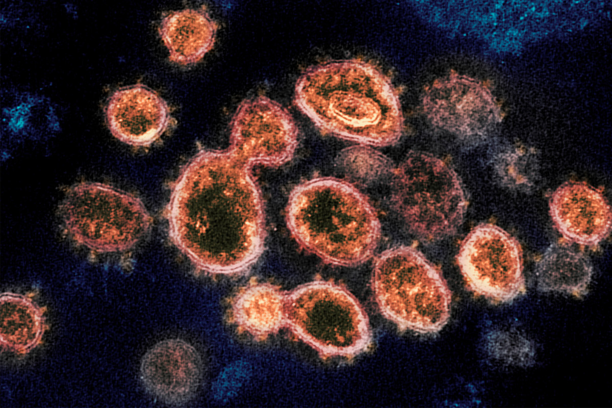 Researchers believe COVID-19 can affect male
fertility 1