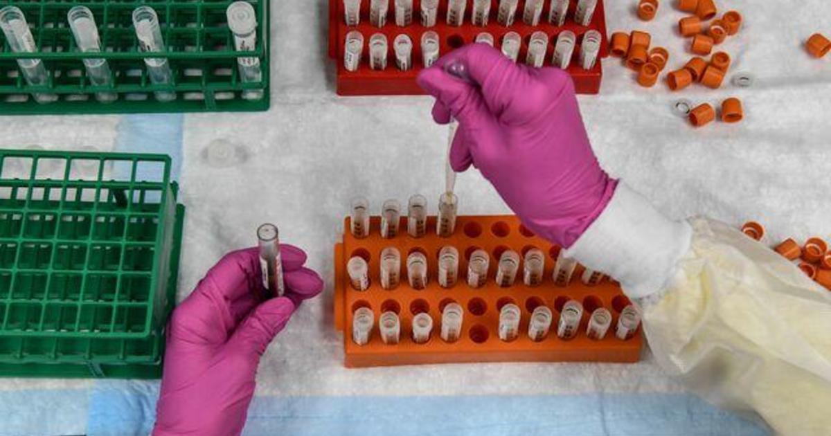 Former HHS Secretary Tom Price on the coronavirus
pandemic 1