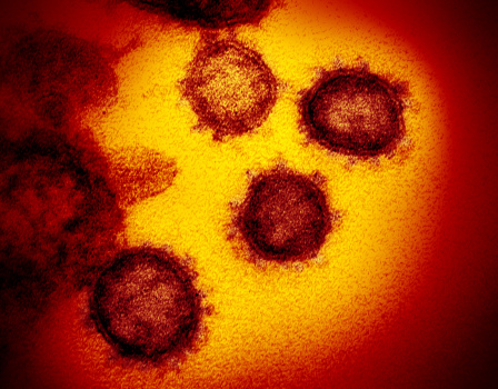 Coronavirus: Doug Wilson says some San Jose Sharks players
who were overseas tested positive 1