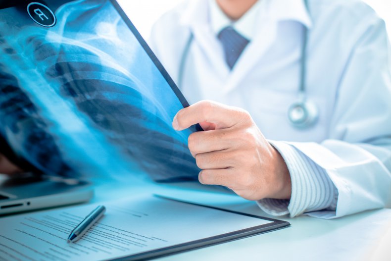 Millions Miss Out on Lifesaving Scans Caused by COVID-19
Backlog 1