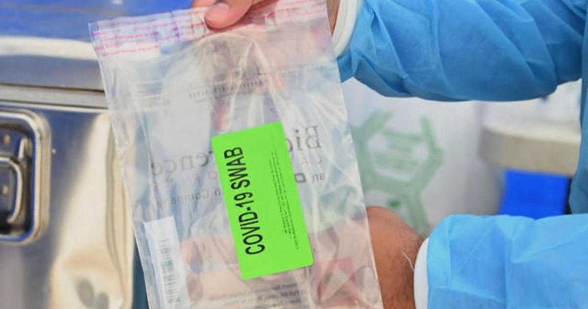 COVID-19 testing overwhelms microbiology labs 1