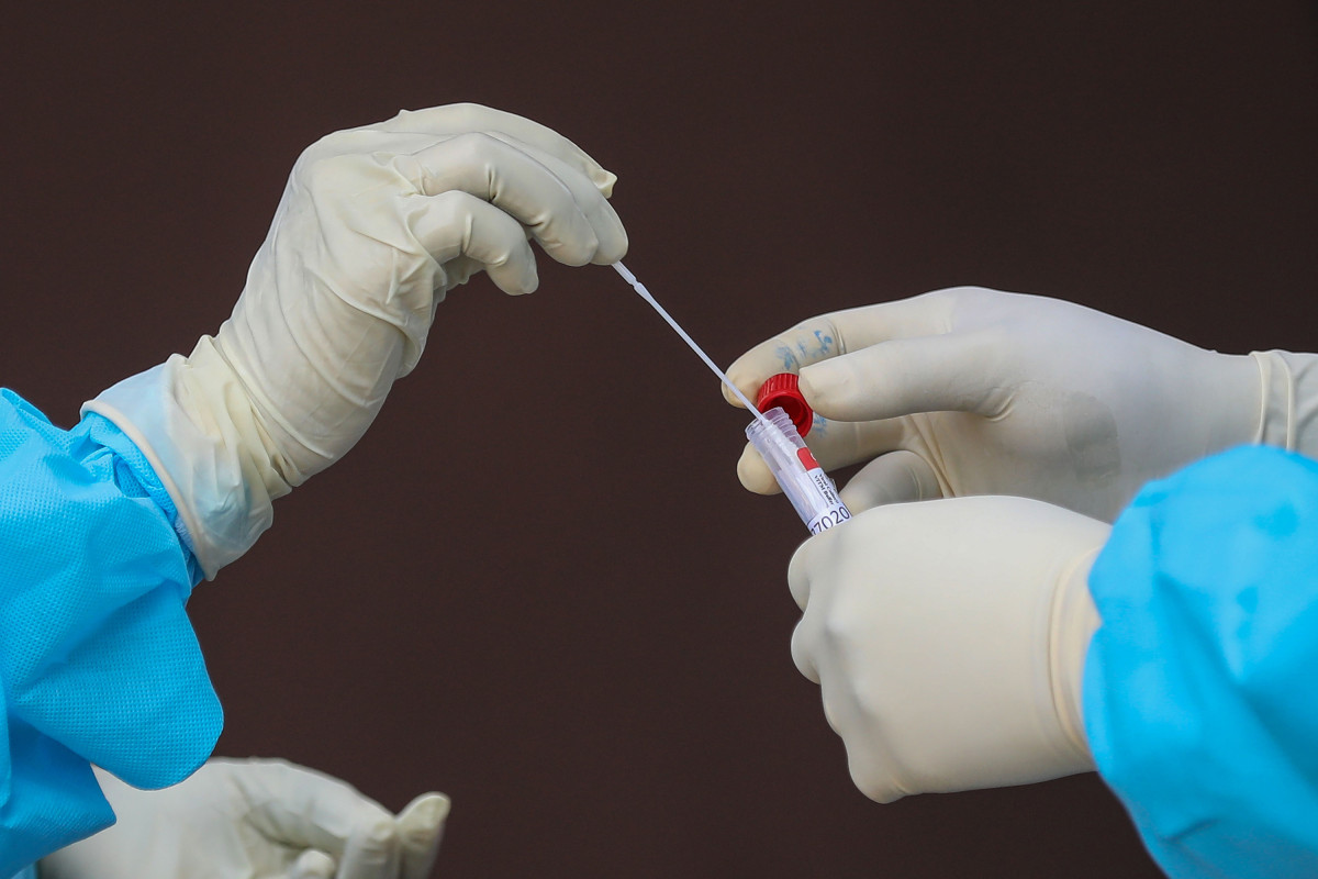 China using anal swabs to detect COVID-19: report 1