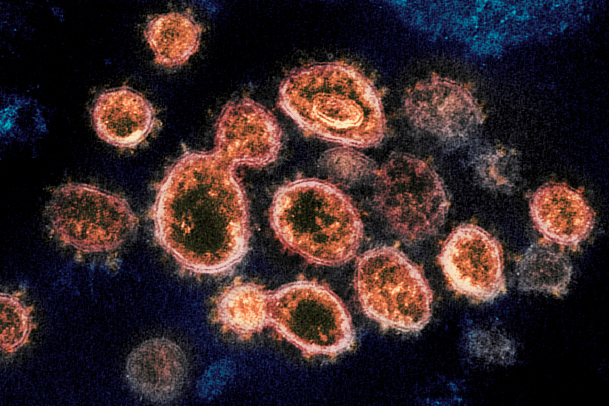 California may have its own highly contagious homegrown
COVID-19 strain 1