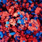 How COVID-19 Attacks The Brain And May Cause Lasting
Damage 12