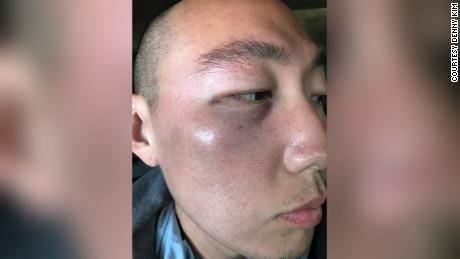 Jeremy Lin says he's been called 'coronavirus' on the
court 1