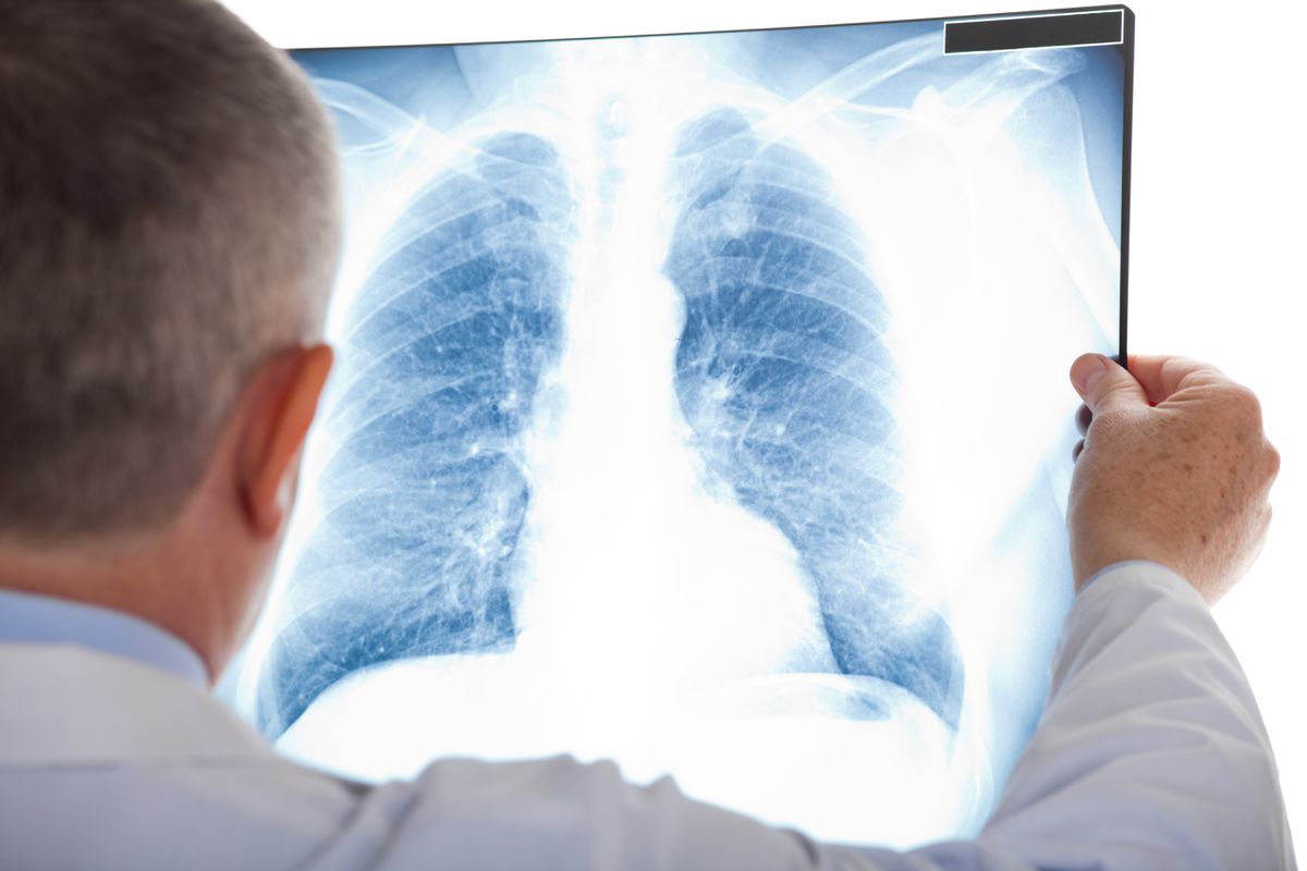Michigan woman dies after double lung transplant from
patient with COVID-19 1 Michigan woman dies after double lung transplant from
patient with COVID-19 1