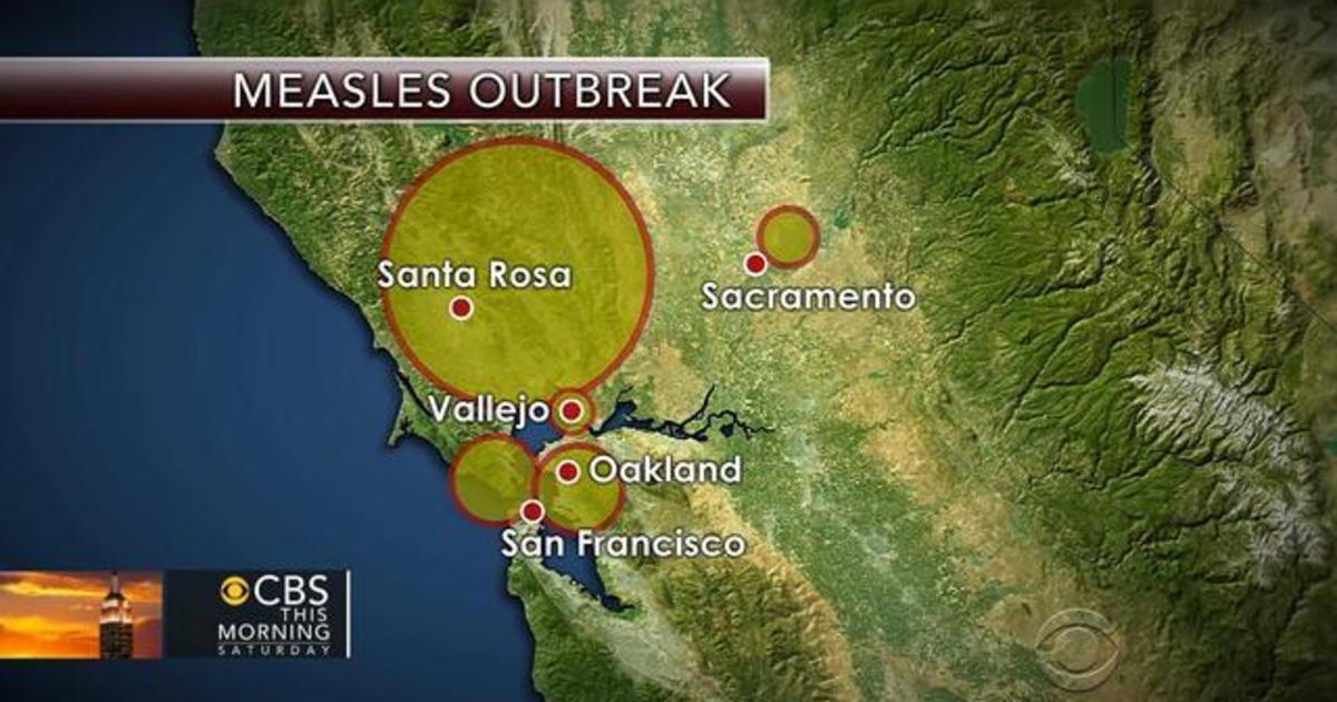 Measles outbreak: More than two dozen children
quarantined 1