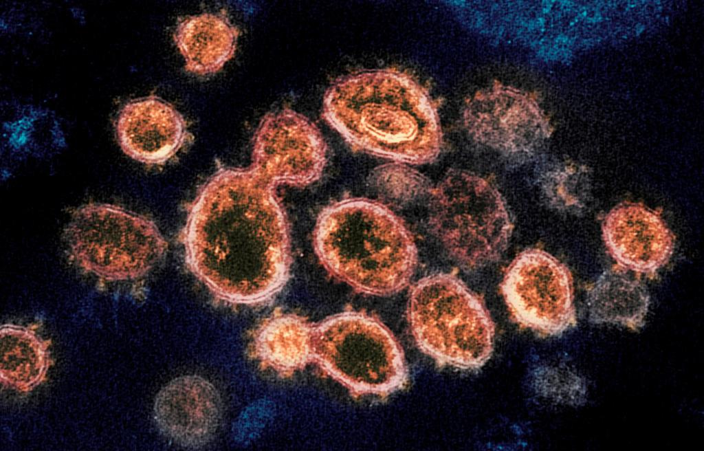 Colorado officials say two COVID-19 variants on the
rise 1