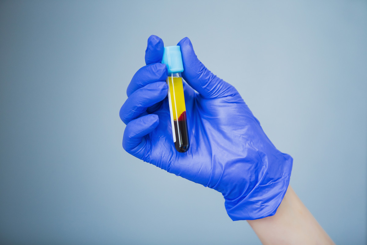 US halts plasma study to treat mild COVID-19, citing
‘unlikely benefit’ 1