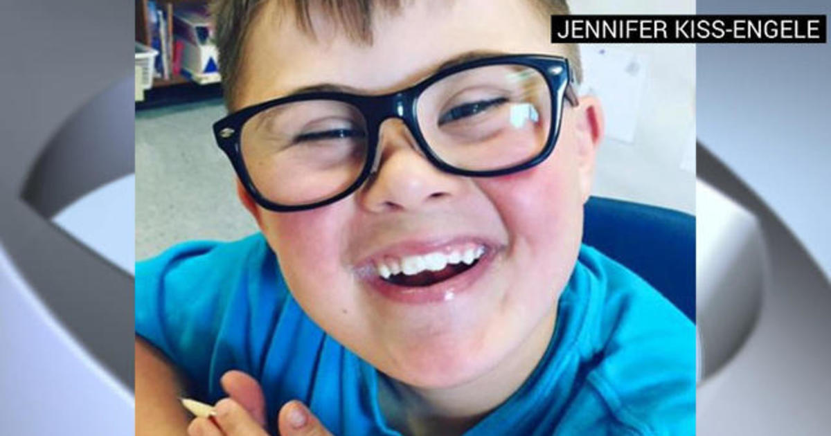Mom writes open letter about her son with Down
syndrome 1