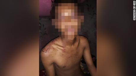 'I thought I would die.' Myanmar protesters describe torture
they suffered in detention 1