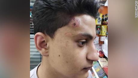 New Jersey police officers charged for allegedly punching a
teen and lying about it 1