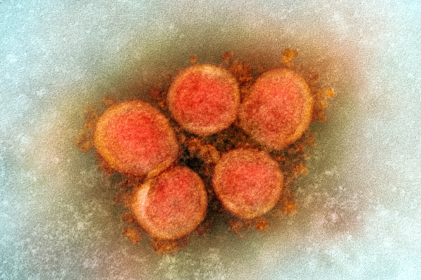 COVID-19 vaccines work well against California variant,
scientists say 1