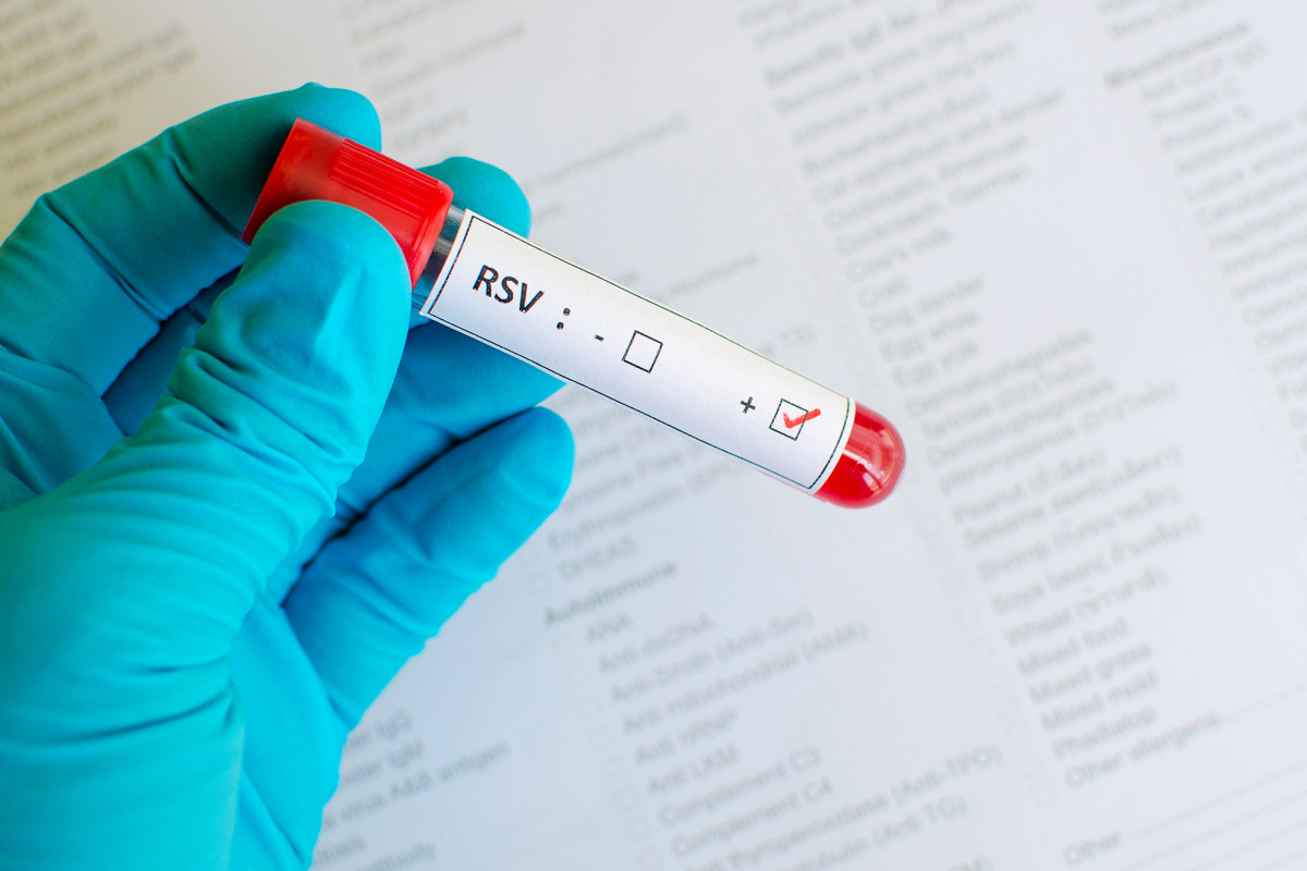 UK bracing for surge in sick kids after COVID lockdown
lowered immunity to common virus 1