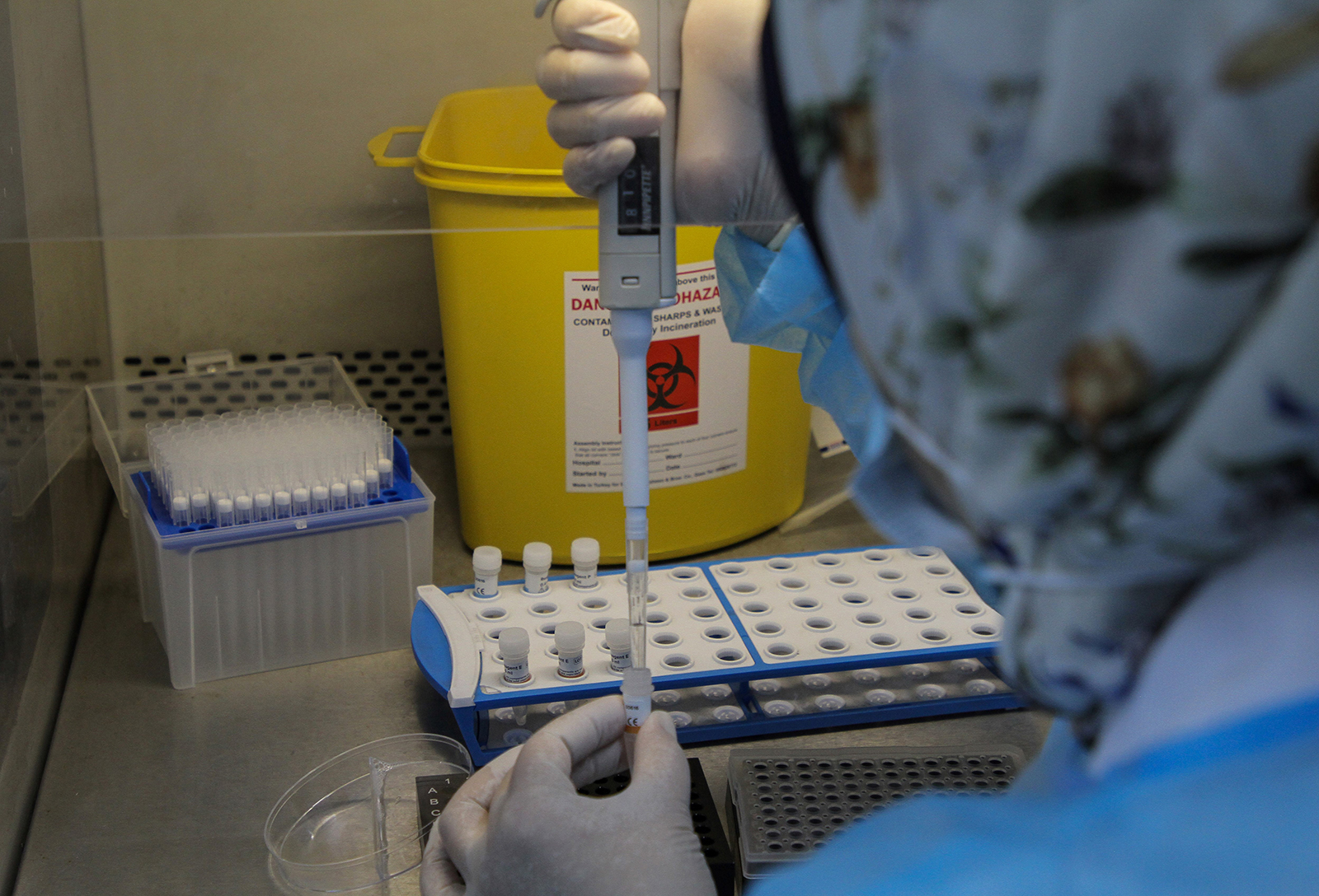 Pelosi says Congress mask rules will stay in place until
more members are vaccinated 1 Pelosi says Congress mask rules will stay in place until
more members are vaccinated 1