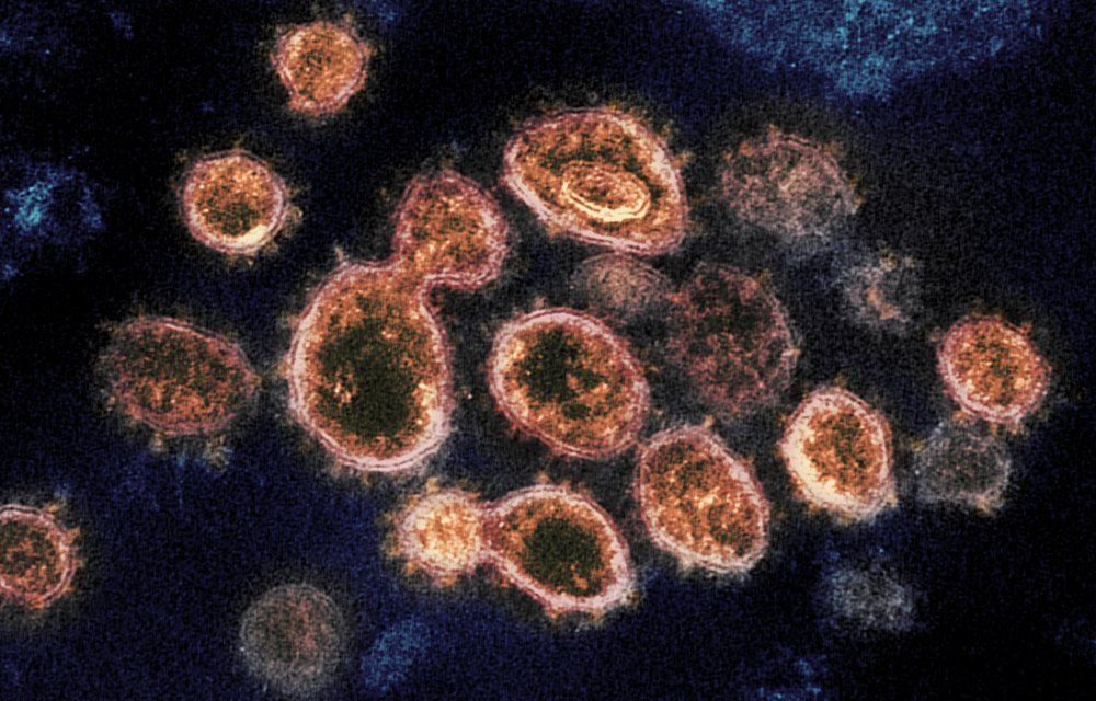 COVID: It’s not just Delta — other coronavirus variants
worry scientists, also 1