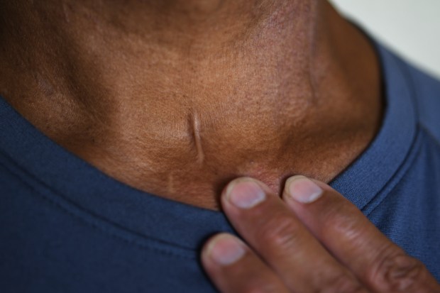 Denver COVID-19 survivor recalls ICU terror, urges others to
get the shot: “That little bug is still a killer” 1