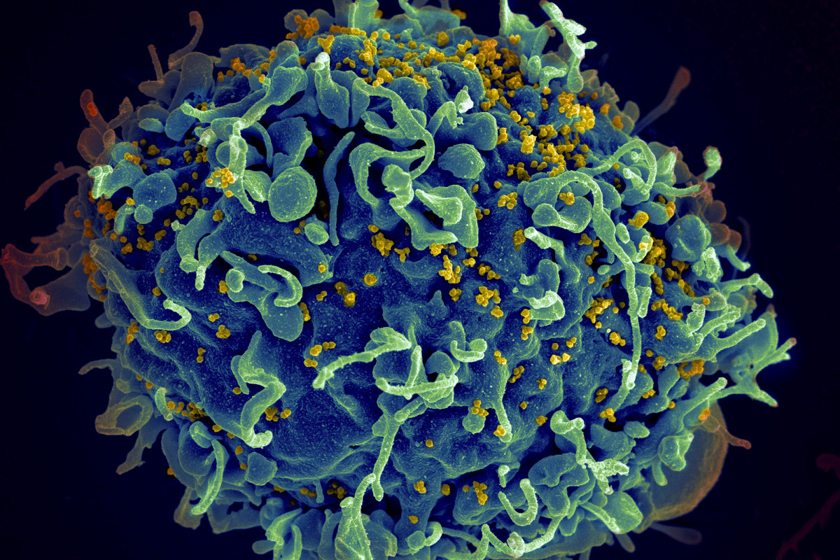 UN urges action to end AIDS, saying COVID-19 hurt
progress 1
