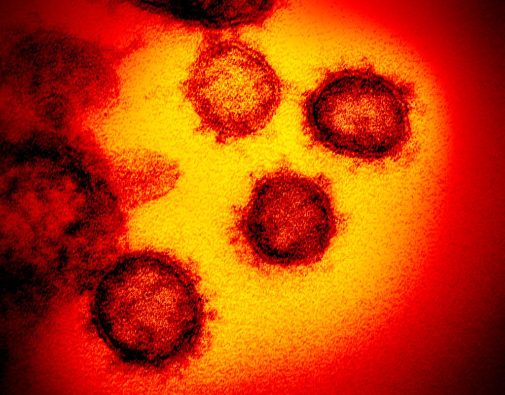 47 at Bay Area homeless shelter infected with
coronavirus 1