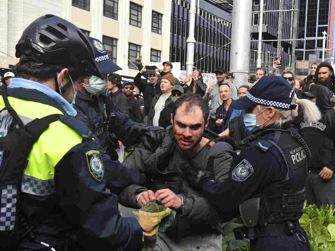 Thousands Of People Protest Coronavirus Lockdowns In
Australia 1