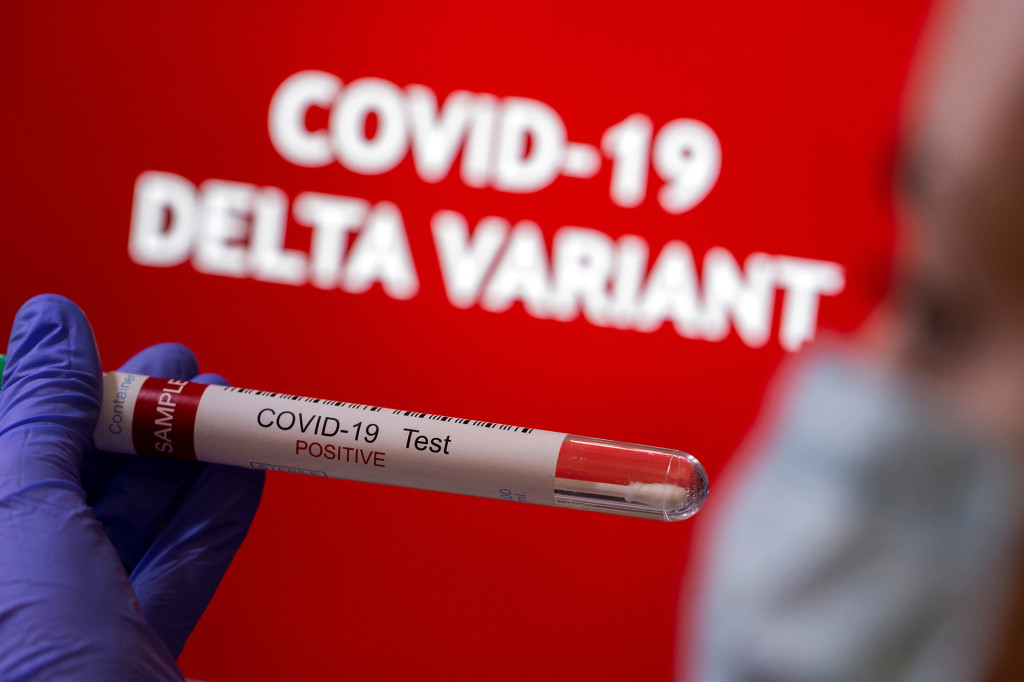 Beyond Delta, scientists are watching new coronavirus
variants 1