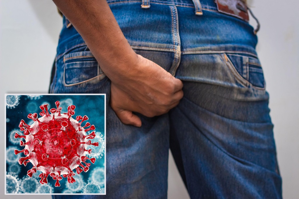 COVID-19’s latest bizarre side effect: ‘Restless anal
syndrome’ 1