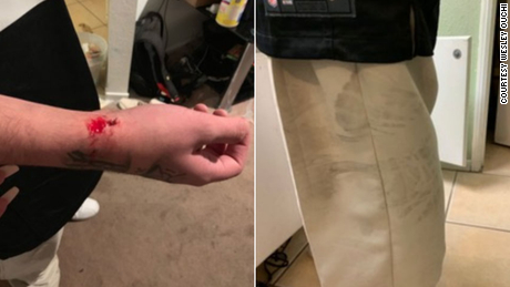California police officer charged with assaulting a teenager
during a traffic stop 1