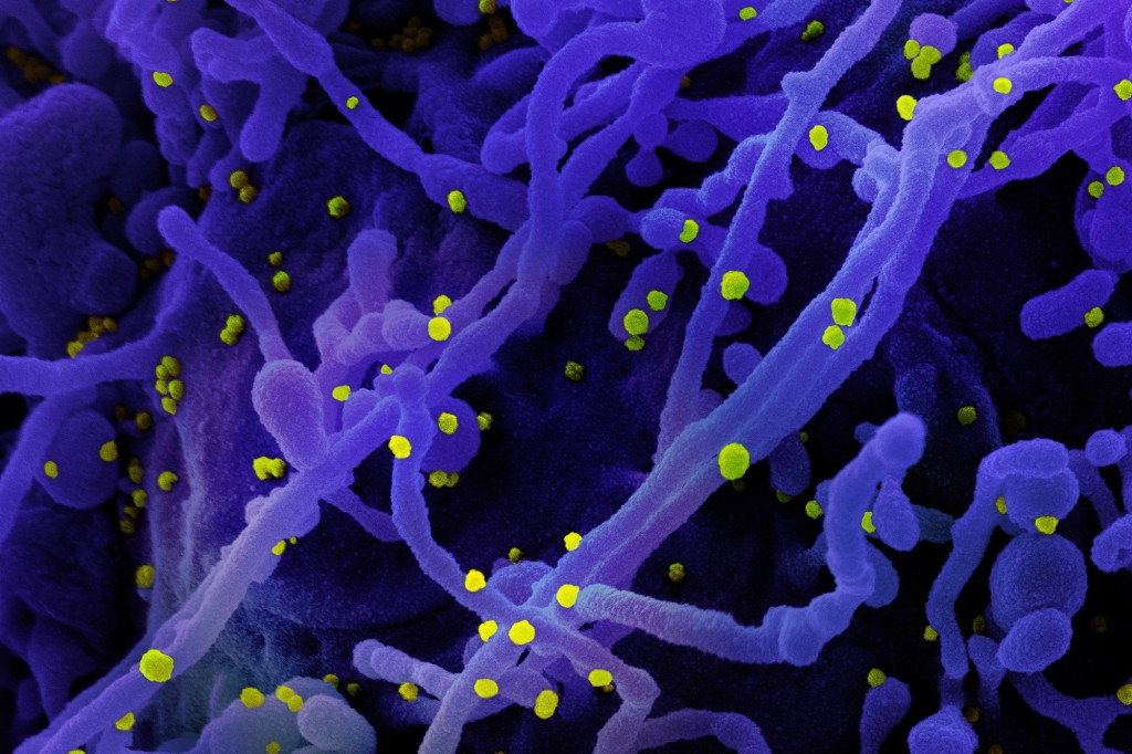Can new variants of the coronavirus keep emerging? 1