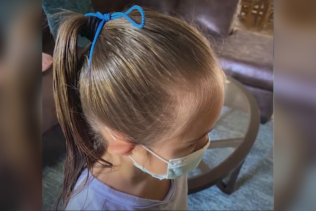 Father accuses school of tying mask to head of disabled
daughter 1
