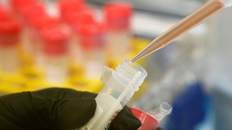 The Coronavirus Attacks Fat Tissue, Scientists Find 1