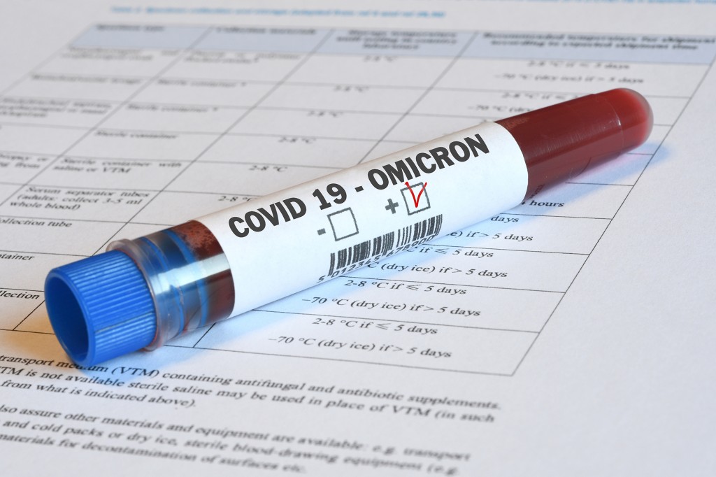 Study shows COVID-19 reinfection 5 times more likely with
omicron 1