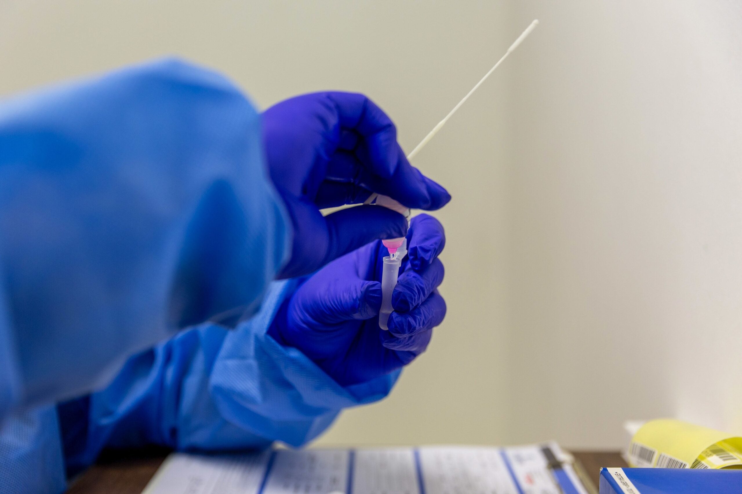 Mass. reports 5,170 new COVID-19 cases, 31 new
deaths 1