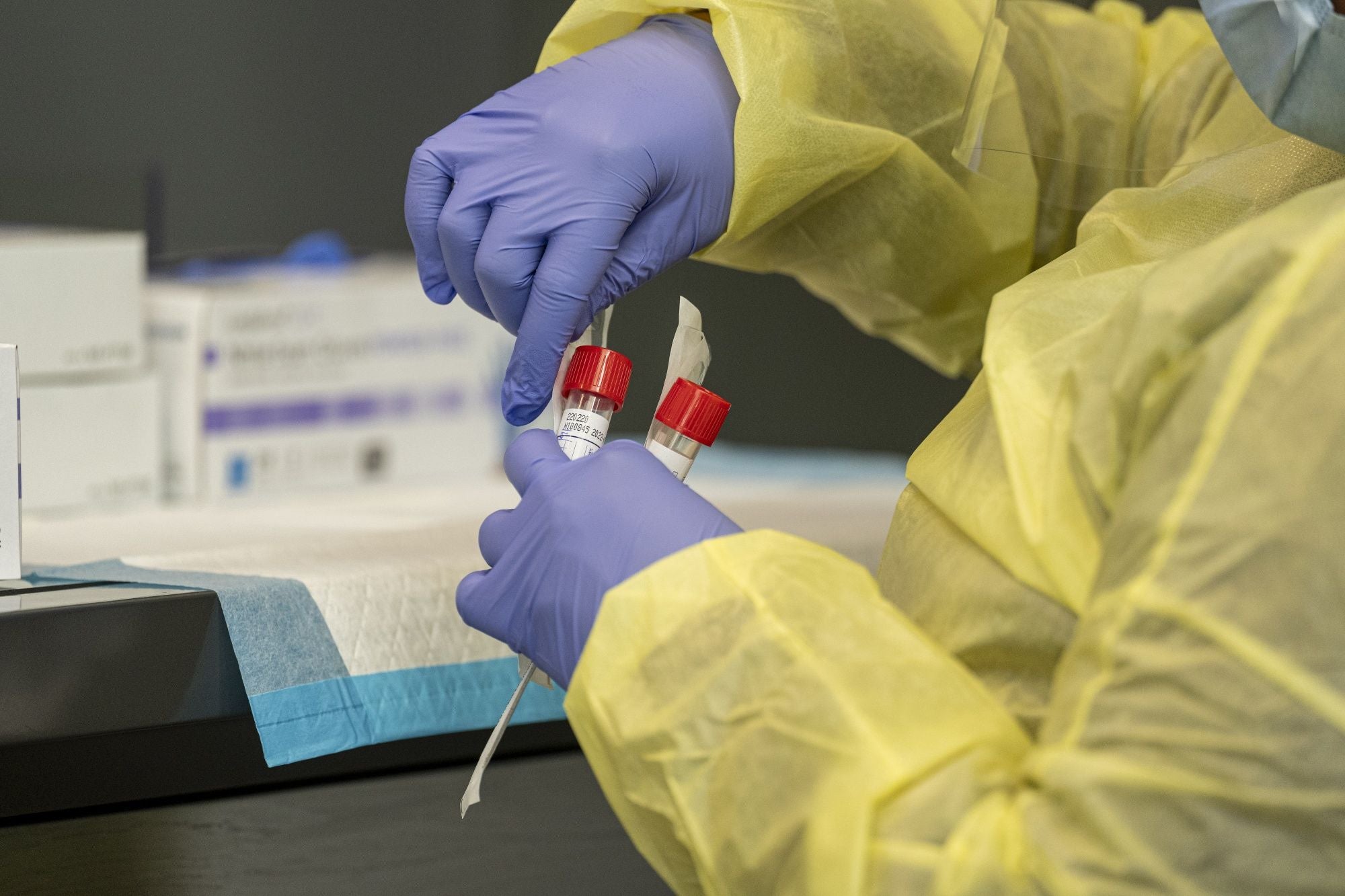 Mass. reports 3,720 new COVID-19 cases, 51 new
deaths 1
