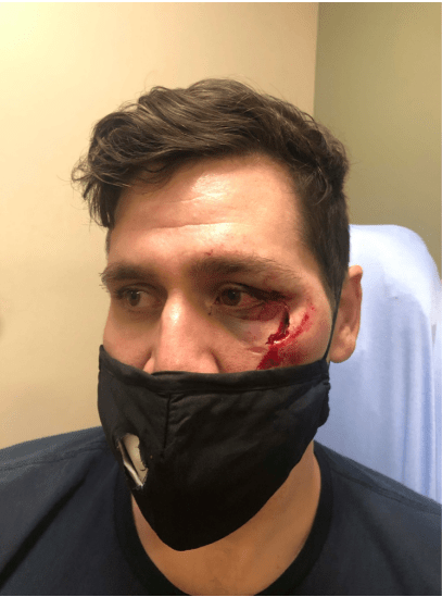 3 men sue Denver after officers shot them in the eye with
less-lethal munitions during 2020 protests 1