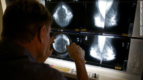 Don't postpone mammograms because of swollen lymph nodes
after Covid-19 vaccine, study says 1