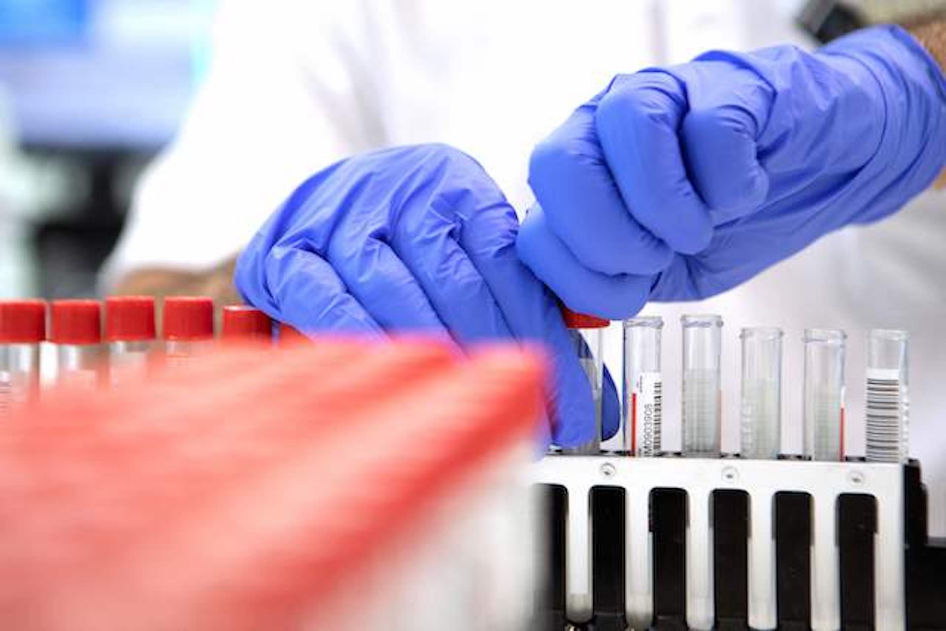 Mass. reports 1,792 new COVID-19 cases from Monday, as well
as 128 new deaths over 3 days 1