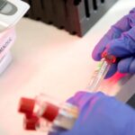 Mass. reports 2,611 new COVID-19 cases, 61 new
deaths 3
