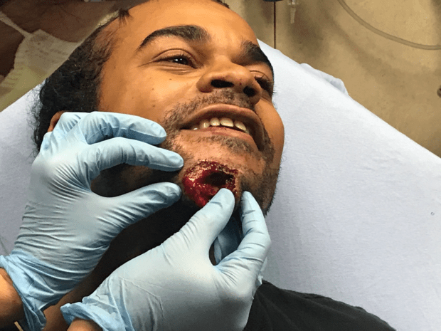 Man who served as volunteer medic during 2020 protests sues
Denver, alleging police shot him in chin with projectile 1